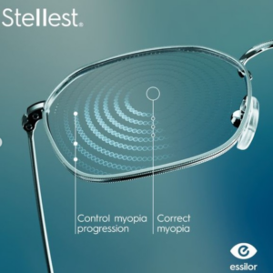 Myopia Management - Stellest Lenses